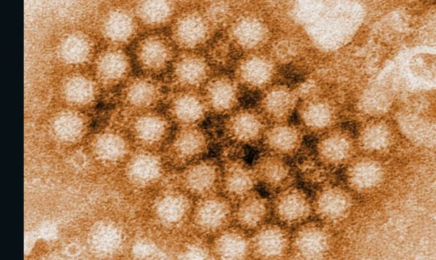 Norovirus virions can live in the environment for up to four weeks....